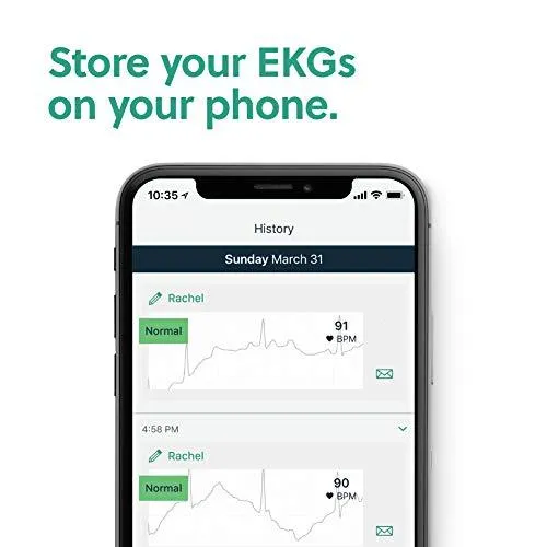 AliveCor KardiaMobile Personal EKG | FDA-Cleared | Detects AFib
