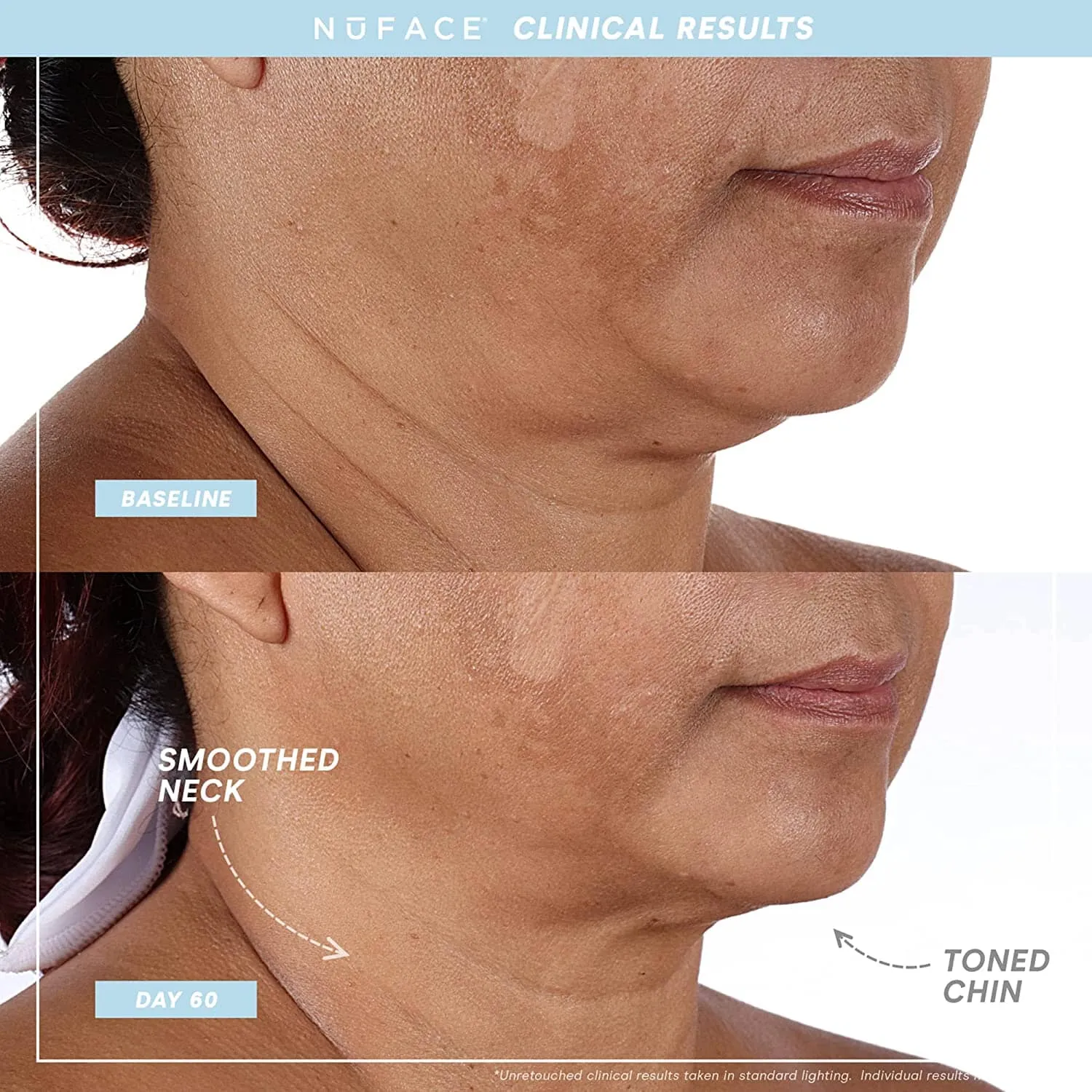 NuFACE TRINITY  Facial Toning Starter Kit