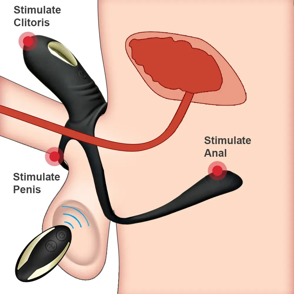 Vibrating Penis Ring with Clitoral and G-Spot Stimulation for Couples